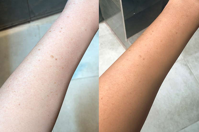 Kristal Before & After How To get Glowing Skin Naturally Apply Gradual Self-Tanning Lotion For Results